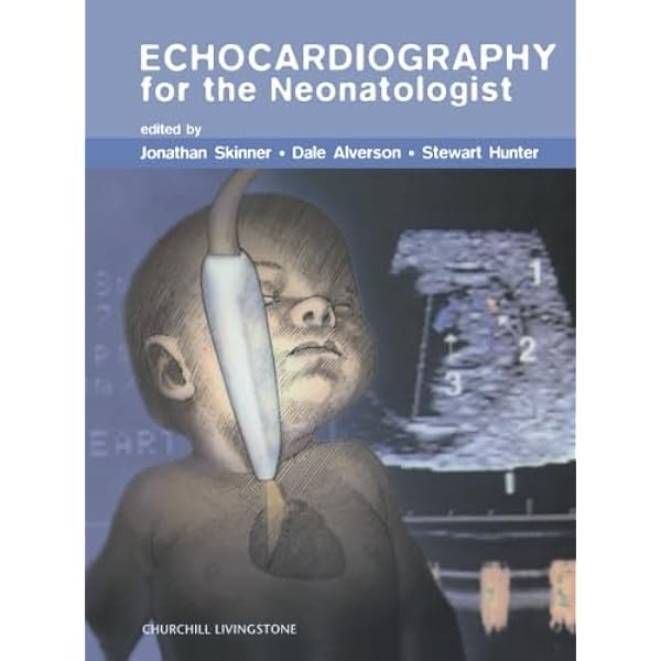 Echocardiographic Anatomy in the Fetus Chiappa， Enrico、 Cook， Andrew C.、 Botta， Gianni; Silverman， Norman H. Echocardiographic Anatomy in the Fetus: 9788847005723: Medicine